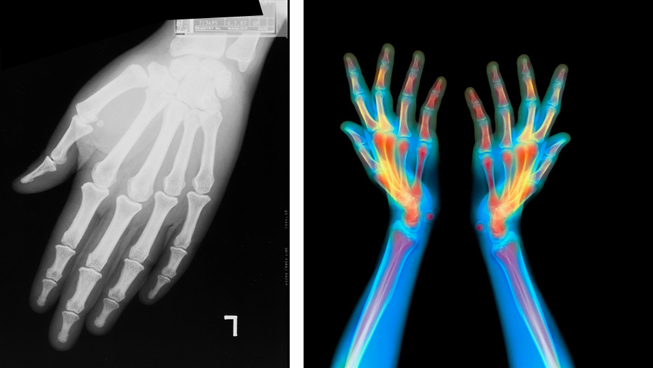 bones1.jpg