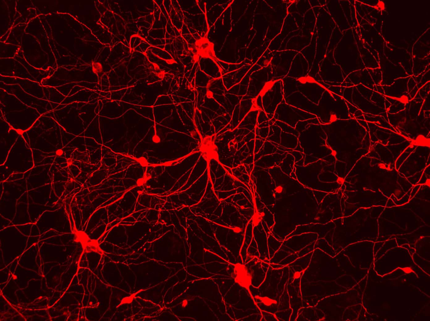 NeuronExample.jpg